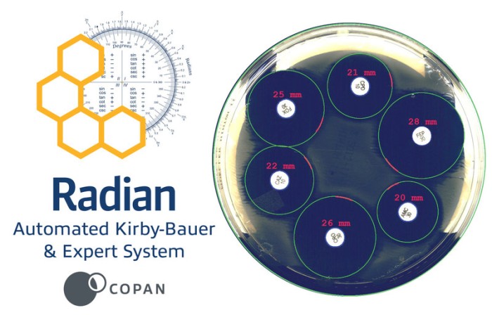 New WASPLab® Module Dedicated to Automation of Disk Diffusion Antibiotic Susceptibility Testing